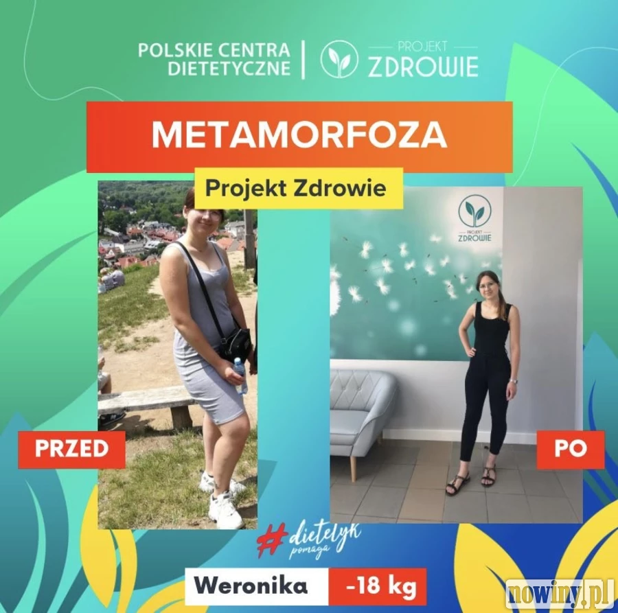 La dietista ayuda: ¡la Sra. Veronica perdió 18 kg en la oficina de nutrición de Projekt Zdrowie!  • Racibórz – nowiny.pl – portal, periódico