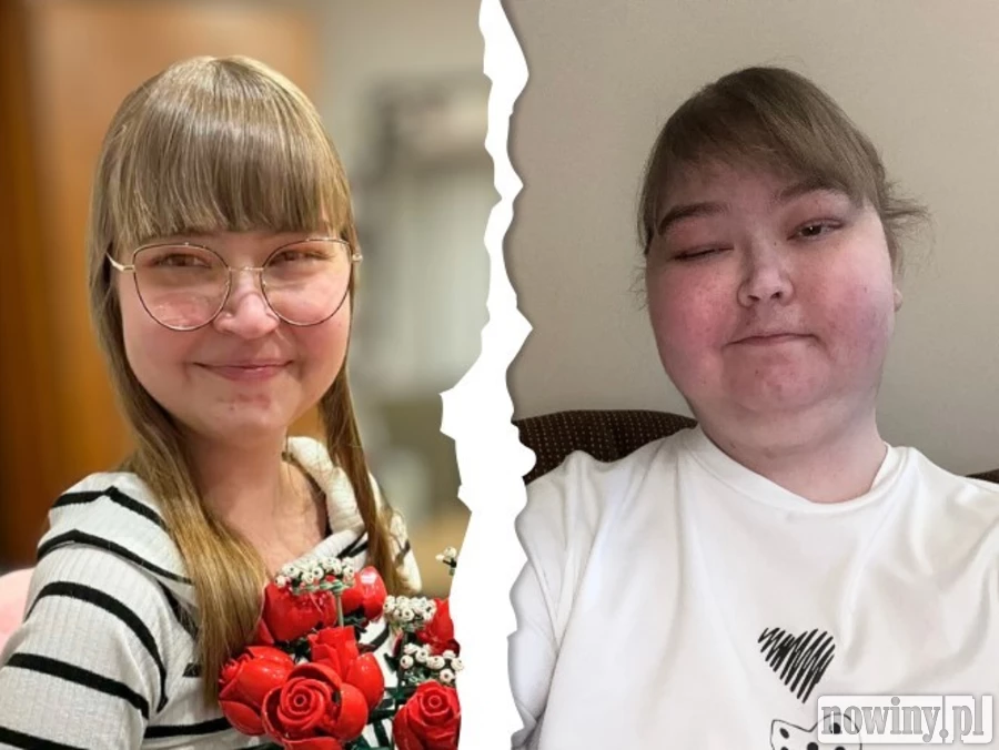 "Nie chcę się poddać". U 22-letniej Martyny zdiagnozowano guza mózgu. Potrzebne kosztowne leczenie